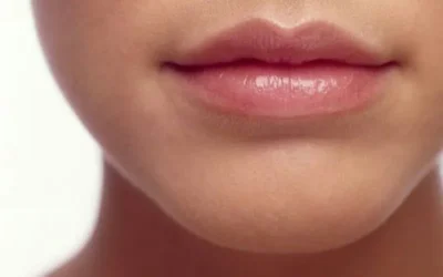 Transformaciones Naturales: Relleno de Labios en la Clínica Teresa Conde Andalucía